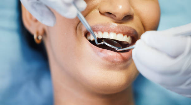Best Emergency Wisdom Teeth Removal in Fulton, KY